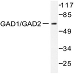 GAD-65/67 (D572) pAb