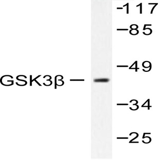 GSK3(beta) (S2) pAb