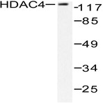 HDAC4 (P626) pAb