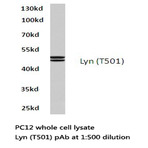 Lyn (T501) pAb