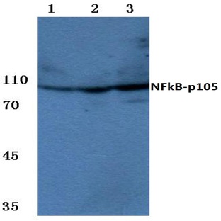 NFkB-p105 (S921) pAb