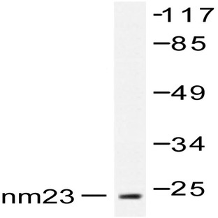 NM23-H2 (H118) pAb