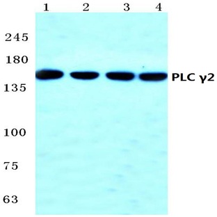 PLC (gamma)2 (R747) pAb