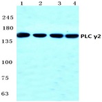 PLC (gamma)2 (R747) pAb