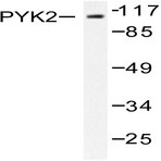 PYK2 (I574) pAb