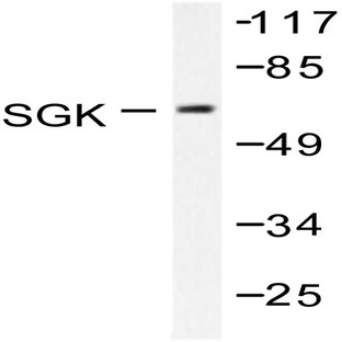 SGK1 (E416) pAb