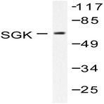 SGK1 (E416) pAb