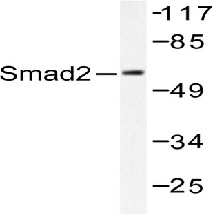 Smad2 (P459) pAb