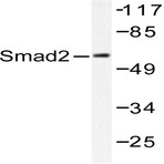 Smad2 (P459) pAb