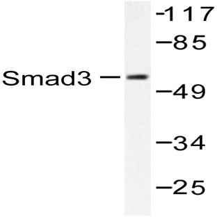 Smad3 (P417) pAb