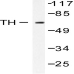 TH (Q25) pAb