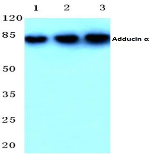 Adducin (alpha) (K439) pAb