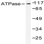 Na+/K+-ATPase (alpha)1 (Y10) pAb