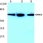 GRK2 (T23) pAb