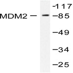 MDM2 (S160) pAb