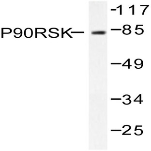 Rsk-1 (T353) pAb