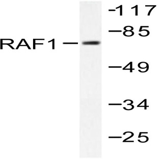 Raf-1 (K615) pAb