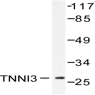 Troponin I3 (A16) pAb