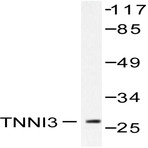 Troponin I3 (A16) pAb