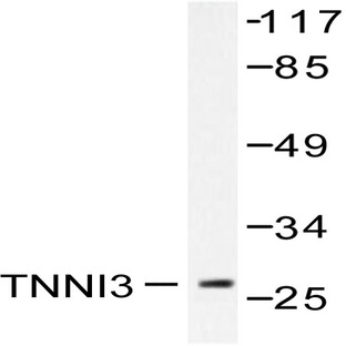 Troponin I3 (G136) pAb