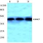 CDK7 (L325) pAb