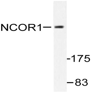 N-CoR (H76) pAb