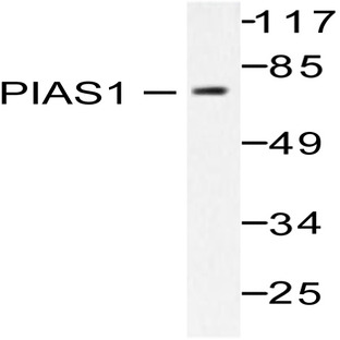 PIAS 1 (G24) pAb