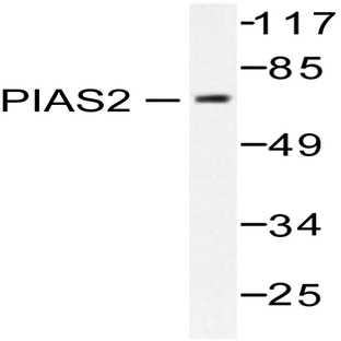 PIASx (G24) pAb