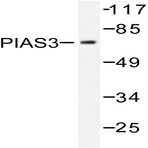 PIAS 3 (F25) pAb