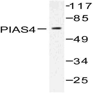 PIASy (D488) pAb