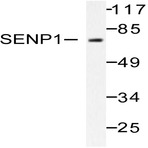 SENP1 (D2) pAb