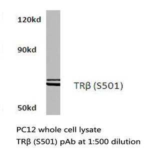 TXNRD2 (S501) pAb