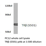 TXNRD2 (S501) pAb