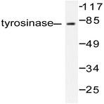 TYR (R501) pAb