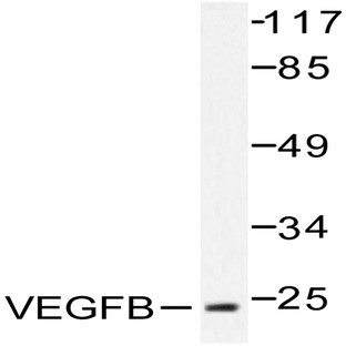 VEGFB (R125) pAb