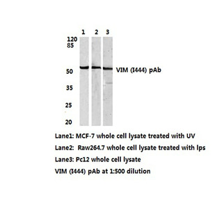 Vimentin (I444) pAb