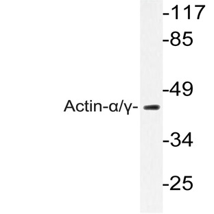 Actin-(alpha)/(gamma) (Q49) pAb