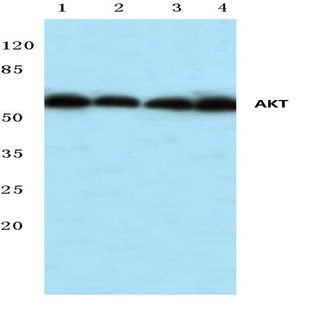 AKT (R69) pAb