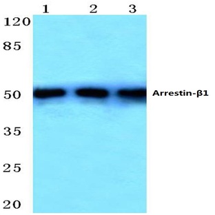 Arrestin-(beta)-1 (E406) pAb