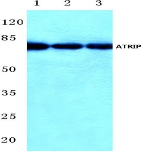 ATRIP (D64) pAb