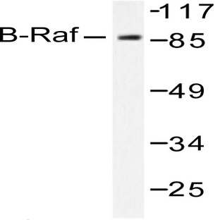 Raf-B (A597) pAb