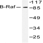 Raf-B (A597) pAb