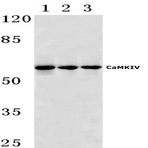 CaMKIV (V192) pAb