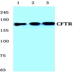 CFTR (E733) pAb