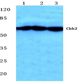 Chk2 (S379) pAb