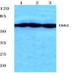 Chk2 (S379) pAb