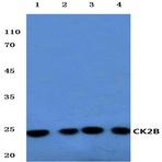 Casein Kinase II(beta) (S205) pAb