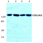 COL1A2 (S3) pAb