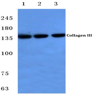 COL3A1 (P104) pAb