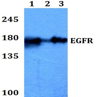 EGFR (V1010) pAb